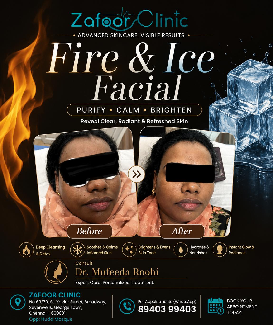 Fire and Ice Facial before and after at Zafoor Clinic Chennai