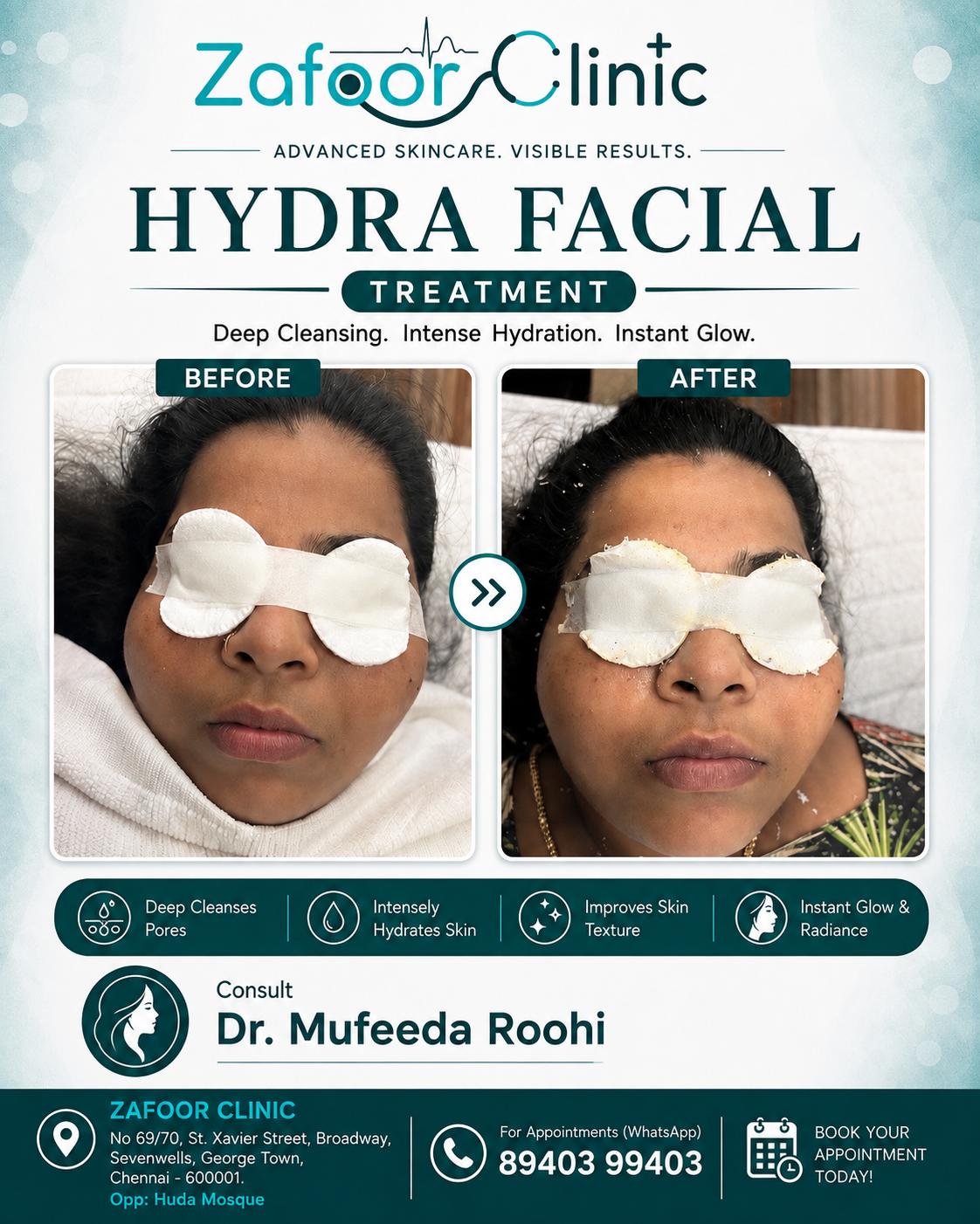 Hydra Facial before and after at Zafoor Clinic Chennai