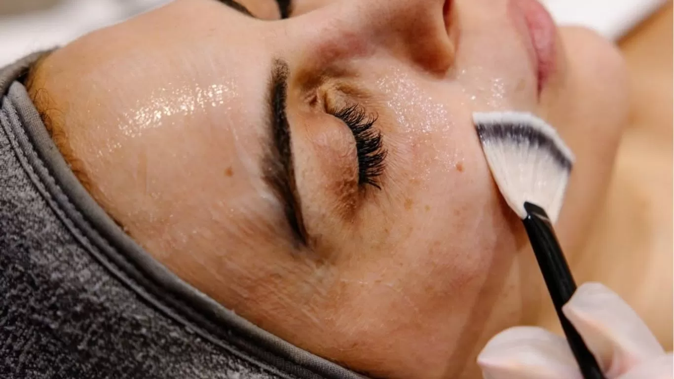 Chemical Peels