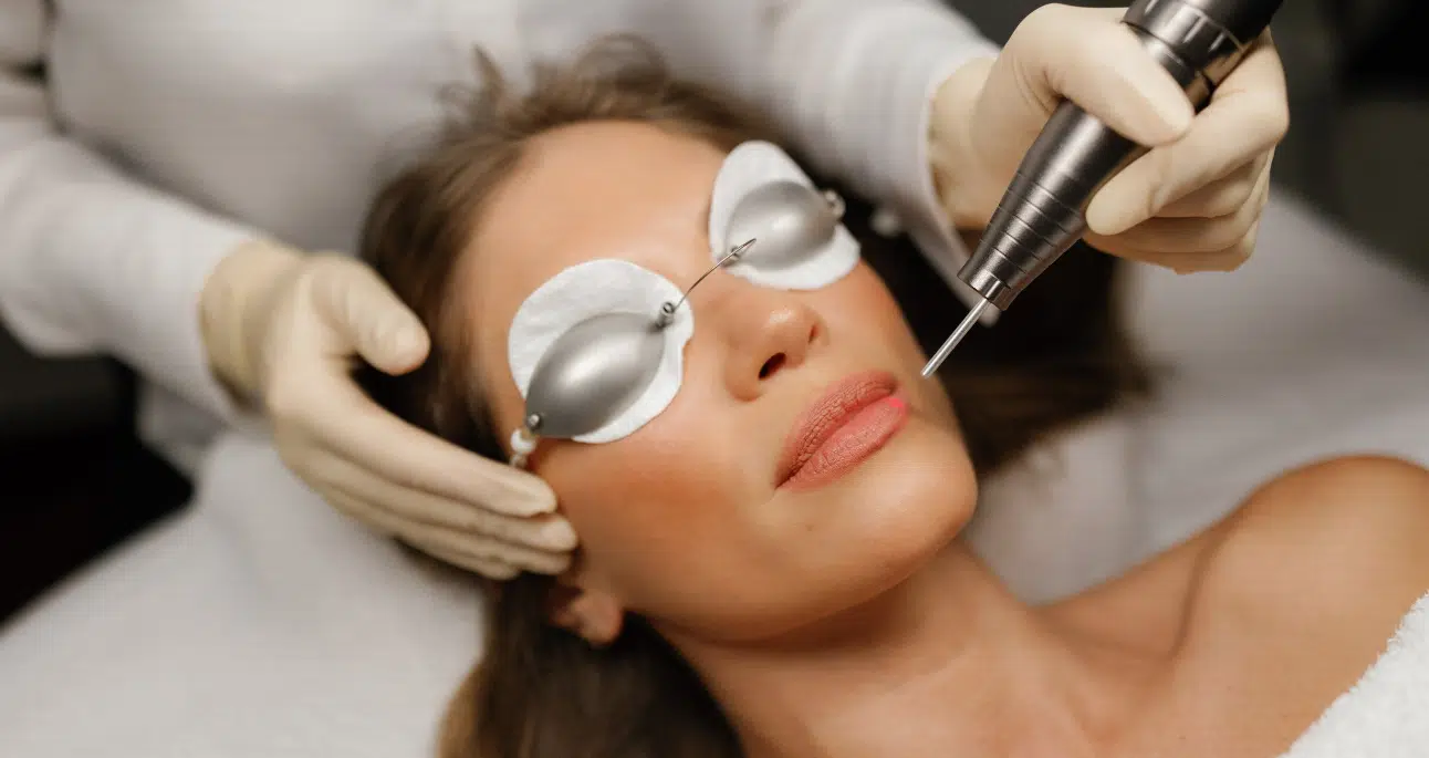Laser Treatments
