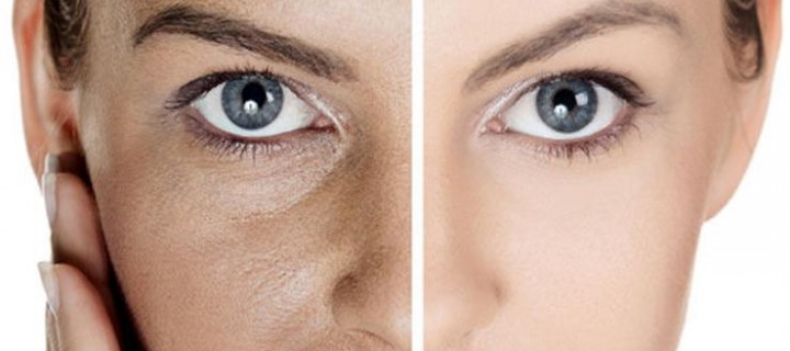 Open Pores Treatment
